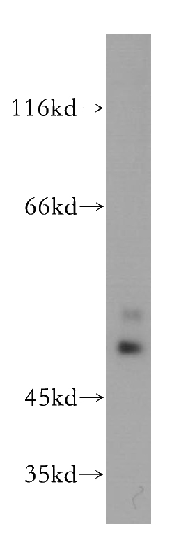 human brain tissue were subjected to SDS PAGE followed by western blot with Catalog No:113339(OLFM2 antibody) at dilution of 1:500