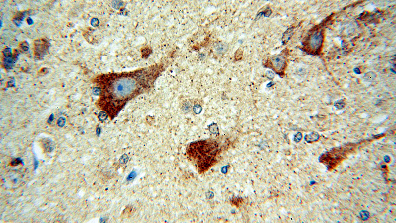 Immunohistochemical of paraffin-embedded human brain using Catalog No:109818(DAAM1 antibody) at dilution of 1:100 (under 40x lens)