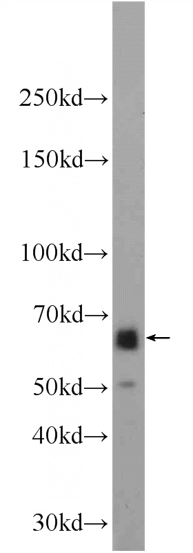 mouse stomach tissue were subjected to SDS PAGE followed by western blot with Catalog No:110318(EEPD1 Antibody) at dilution of 1:600