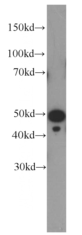 HeLa cells were subjected to SDS PAGE followed by western blot with Catalog No:107525(SEPT8 Antibody) at dilution of 1:1000