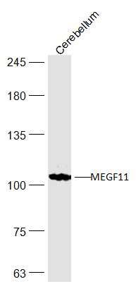 Fig1: Sample:; Cerebellum (Mouse) Lysate at 40 ug; Primary: Anti-MEGF11 at 1/300 dilution; Secondary: IRDye800CW Goat Anti-Rabbit IgG at 1/20000 dilution; Predicted band size: 110 kD; Observed band size: 110 kD