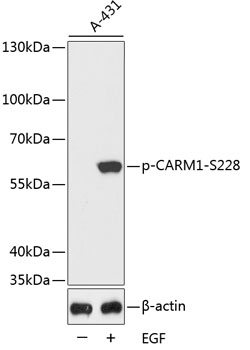 Western blot - Phospho-CARM1-S228 pAb 