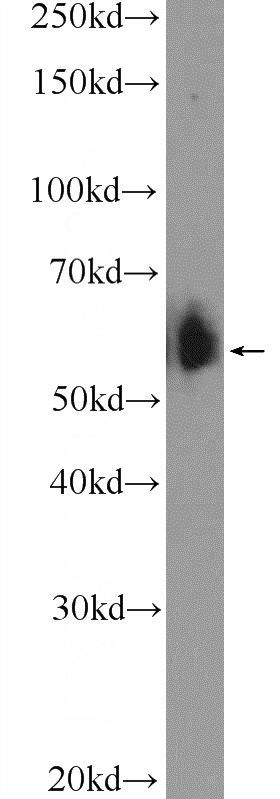 HeLa cells were subjected to SDS PAGE followed by western blot with Catalog No:108413(BAIAP2L1 Antibody) at dilution of 1:600