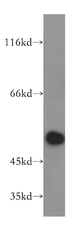 HeLa cells were subjected to SDS PAGE followed by western blot with Catalog No:109886(DEK antibody) at dilution of 1:800