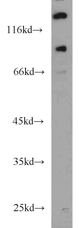 HeLa cells were subjected to SDS PAGE followed by western blot with Catalog No:116615(UNC5A antibody) at dilution of 1:1000
