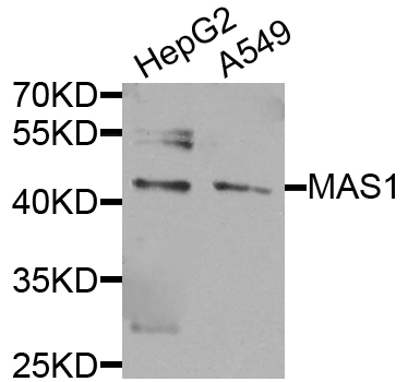Western blot - MAS1 Polyclonal Antibody 