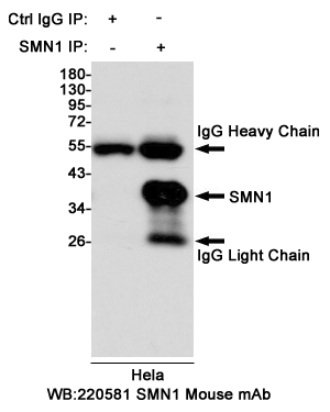 Immunoprecipitation analysis of Hela cell lysates using SMN1 mouse mAb.