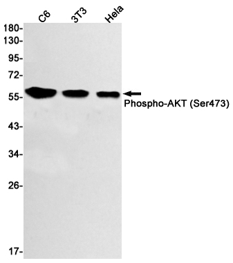 Western blot detection of Phospho-AKT (Ser473) in C6,3T3,Hela cell lysates using Phospho-AKT (Ser473) Rabbit mAb(1:1000 diluted).Predicted band size:56kDa.Observed band size:56kDa.