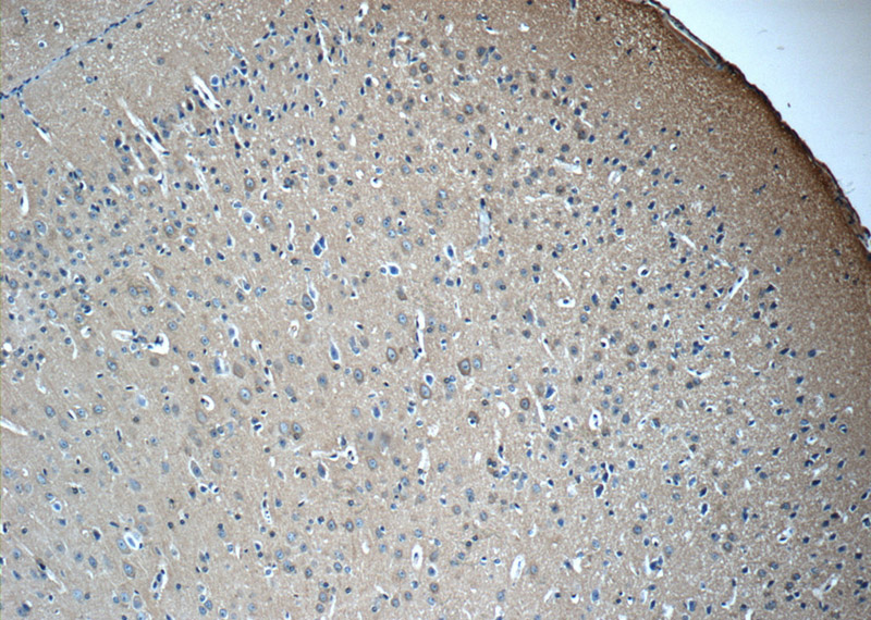Immunohistochemistry of paraffin-embedded mouse brain tissue slide using Catalog No:107658(14-3-3 Antibody) at dilution of 1:50 (under 10x lens)