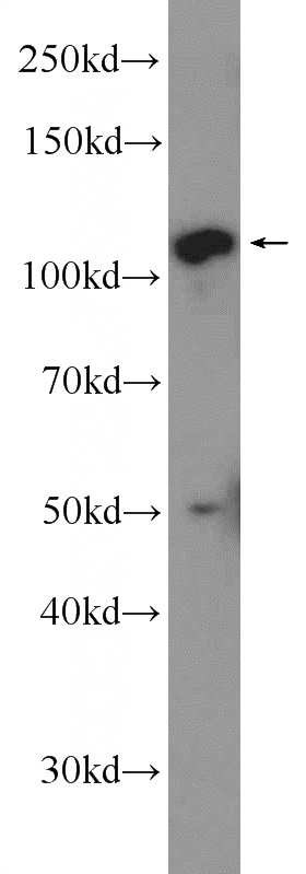 A549 cells were subjected to SDS PAGE followed by western blot with Catalog No:108563(C10orf28 Antibody) at dilution of 1:300