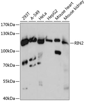 Western blot - RIN2 Polyclonal Antibody 