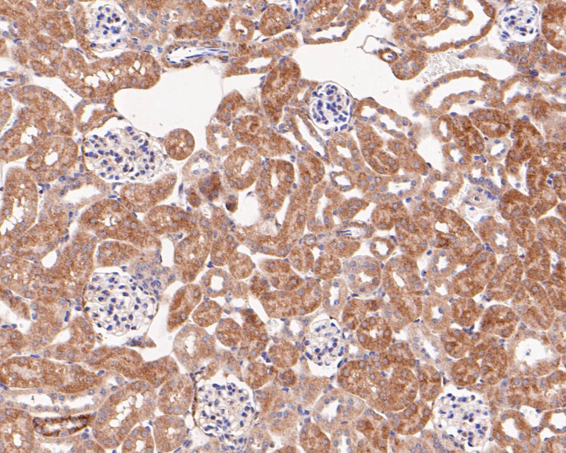 Fig7: Immunohistochemical analysis of paraffin-embedded mouse kidney tissue using anti-SPATIAL antibody. The section was pre-treated using heat mediated antigen retrieval with Tris-EDTA buffer (pH 8.0-8.4) for 20 minutes.The tissues were blocked in 5% BSA