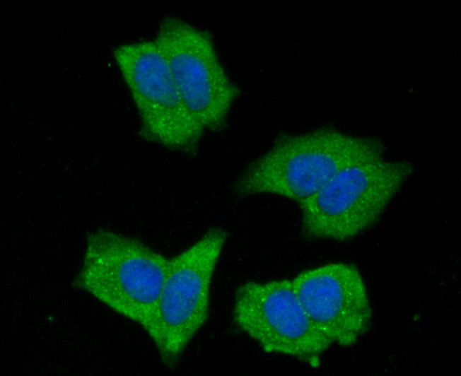 Fig3: ICC staining NLRC3 in MCF-7 cells (green). The nuclear counter stain is DAPI (blue). Cells were fixed in paraformaldehyde, permeabilised with 0.25% Triton X100/PBS.