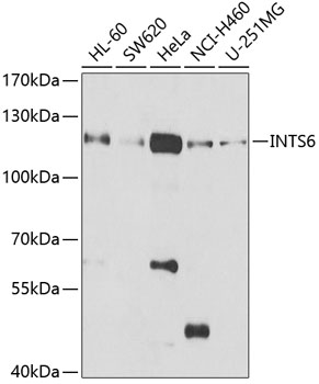 Western blot - INTS6 Polyclonal Antibody 