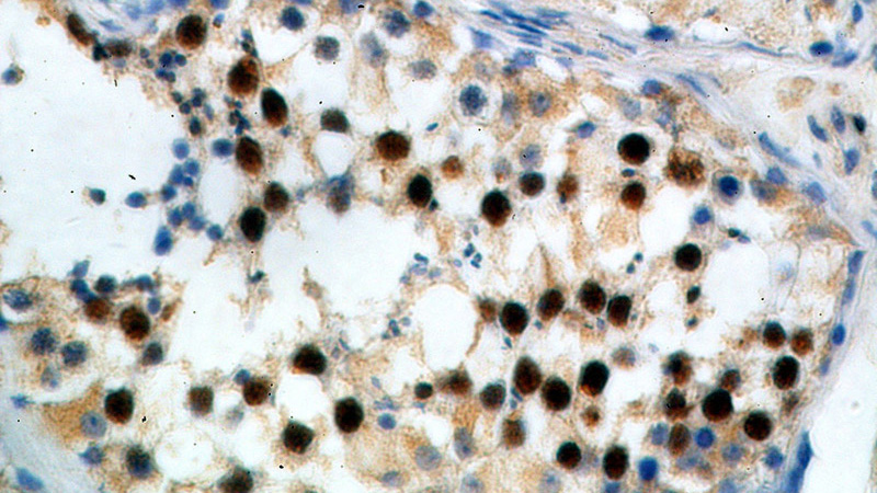 Immunohistochemical of paraffin-embedded human testis using Catalog No:114870(RUFY2 antibody) at dilution of 1:100 (under 40x lens)