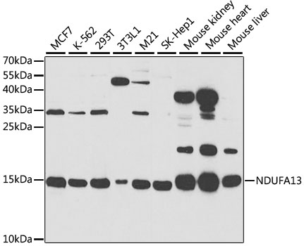 Western blot - NDUFA13 Polyclonal Antibody 