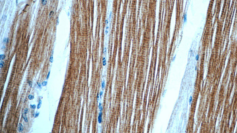 Immunohistochemistry of paraffin-embedded human skeletal muscle tissue slide using Catalog No:116164(TOB2 Antibody) at dilution of 1:50 (under 40x lens)
