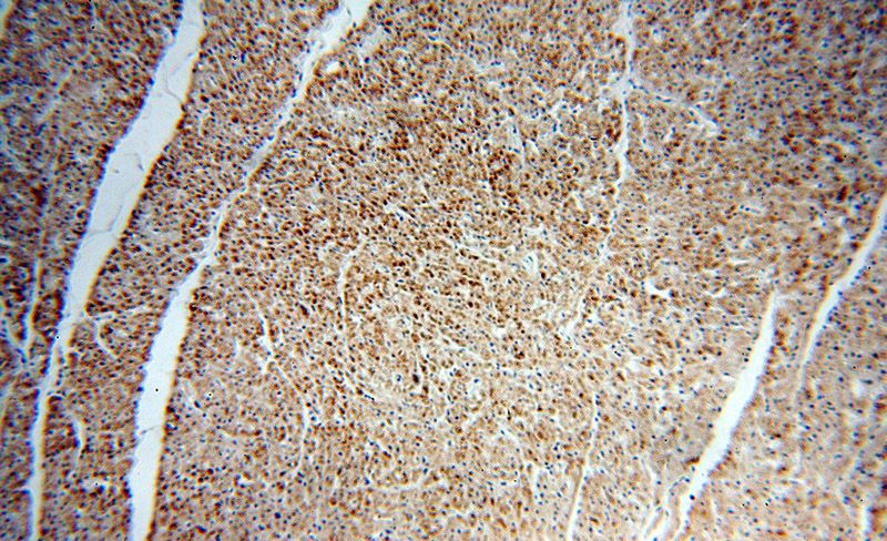 Immunohistochemical of paraffin-embedded human heart using Catalog No:113646(PECI antibody) at dilution of 1:100 (under 10x lens)