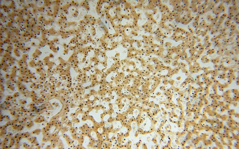 Immunohistochemical of paraffin-embedded human liver using Catalog No:111554(HSDL1 antibody) at dilution of 1:100 (under 10x lens)