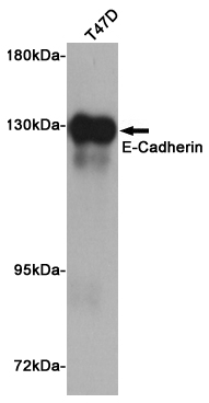 Western blot analysis of extract from T47D cells using E-Cadherin Mouse mAb at 1:1000 dilution. Predicted band size: 135KDa. Observed band size: 135KDa.