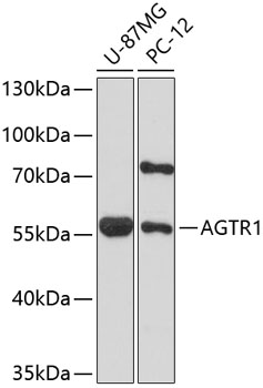 Western blot - AGTR1 Polyclonal Antibody 