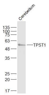 Fig2: Sample:; Cerebellum (Mouse) Lysate at 40 ug; Primary: Anti-TPST1 at 1/1000 dilution; Secondary: IRDye800CW Goat Anti-Rabbit IgG at 1/20000 dilution; Predicted band size: 41 kD; Observed band size: 51 kD