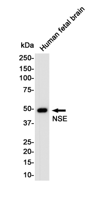 Western blot detection of Enolase-2/NSE in Human Fetal Brain lysates using Enolase-2/NSE Rabbit pAb(1:1000 diluted).Predicted band size:47KDa.Observed band size:47KDa.