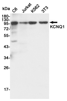 Western blot detection of KCNQ1 in C6,Jurkat,K562 and 3T3 cell lysates using KCNQ1 mouse mAb (1:3000 diluted).Predicted band size:95KDa.Observed band size:95KDa.