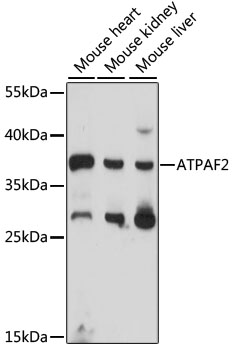 Western blot - ATPAF2 Polyclonal Antibody 