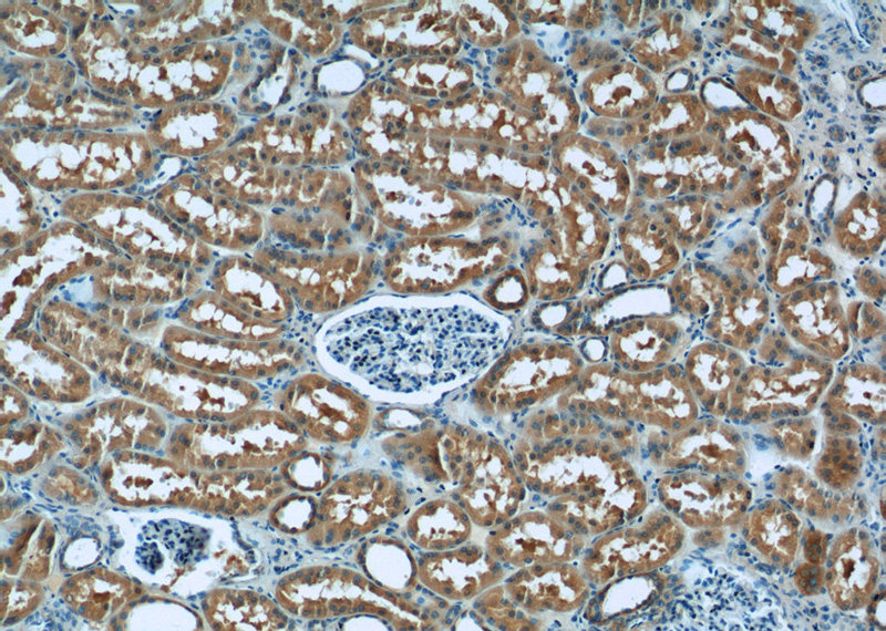 Immunohistochemistry of paraffin-embedded human kidney tissue slide using Catalog No:108352(ATP5D Antibody) at dilution of 1:50 (under 10x lens)