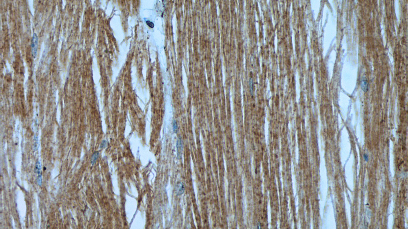 Immunohistochemistry of paraffin-embedded human skeletal muscle tissue slide using Catalog No:110553(FBXO32 Antibody) at dilution of 1:50 (under 40x lens)