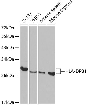 Western blot - HLA-DPB1 Polyclonal Antibody 