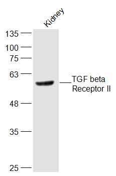 Fig1: Sample:; Kidney (Mouse) Lysate at 40 ug; Primary: Anti-TGF beta Receptor II at 1/300 dilution; Secondary: IRDye800CW Goat Anti-Rabbit IgG at 1/20000 dilution; Predicted band size: 62 kD; Observed band size: 62 kD