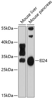 Western blot - EI24 Polyclonal Antibody 