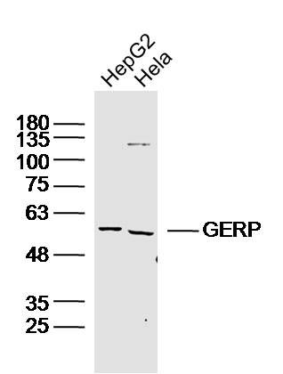 Fig2: Sample:; HepG2 Cell (Human) Lysate at 30 ug; Hela Cell(Human)Lysate at 30 ug; Primary: Anti- GERP at 1/300 dilution; Secondary: IRDye800CW Goat Anti-Rabbit IgG at 1/20000 dilution; Predicted band size: 61kD; Observed band size: 61kD