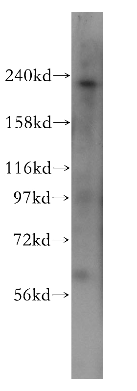 human brain tissue were subjected to SDS PAGE followed by western blot with Catalog No:113878(PI4KA antibody) at dilution of 1:400