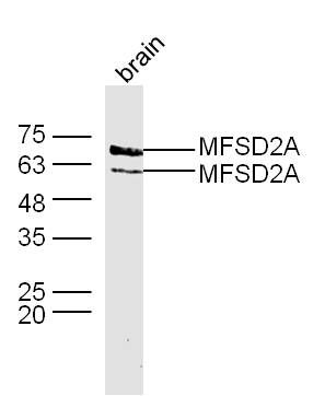 Fig2: Sample: Brain (Mouse) Lysate at 40 ug; Primary: Anti-MFSD2A at 1/300 dilution; Secondary: IRDye800CW Goat Anti-Rabbit IgG at 1/20000 dilution; Predicted band size: 60 kD; Observed band size: 60/65 kD