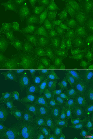 Immunofluorescence - ZBTB20 Polyclonal Antibody 