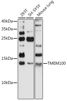 Western blot - TMEM100 Polyclonal Antibody 