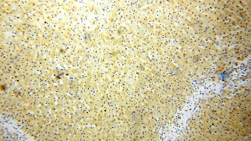 Immunohistochemical of paraffin-embedded human liver using Catalog No:116566(ULBP1 antibody) at dilution of 1:50 (under 10x lens)