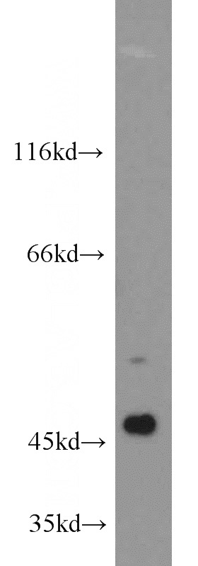 HeLa cells were subjected to SDS PAGE followed by western blot with Catalog No:108881(CASP9 antibody) at dilution of 1:1000