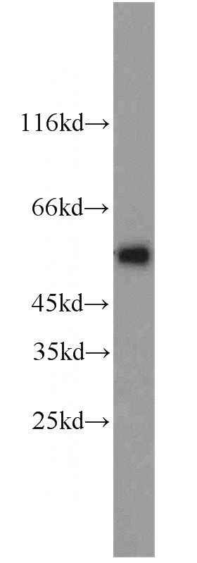 3T3-L1 cells were subjected to SDS PAGE followed by western blot with Catalog No:115706(STEAP4 antibody) at dilution of 1:1000