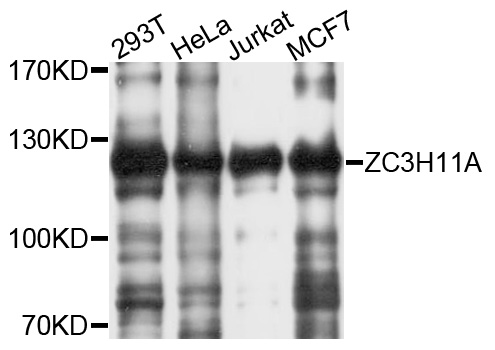 Western blot - ZC3H11A Polyclonal Antibody 