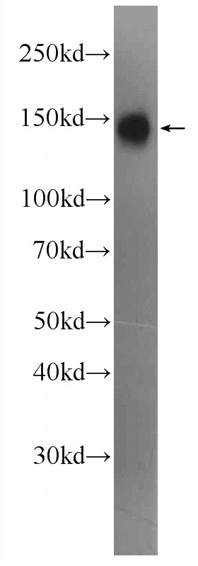 Jurkat cells were subjected to SDS PAGE followed by western blot with Catalog No:115153(SFRS8 Antibody) at dilution of 1:2000