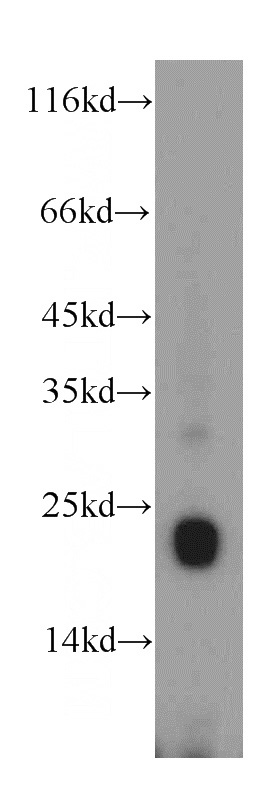 human placenta tissue were subjected to SDS PAGE followed by western blot with Catalog No:111218(GH1 antibody) at dilution of 1:1000