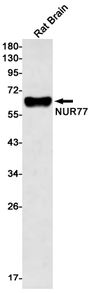 Western blot detection of NUR77 in Rat Brain lysates using NUR77 Rabbit mAb(1:500 diluted).Predicted band size:65kDa.Observed band size:65kDa.