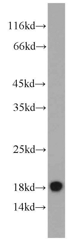 HEK-293 cells were subjected to SDS PAGE followed by western blot with Catalog No:113538(P16 antibody) at dilution of 1:1000