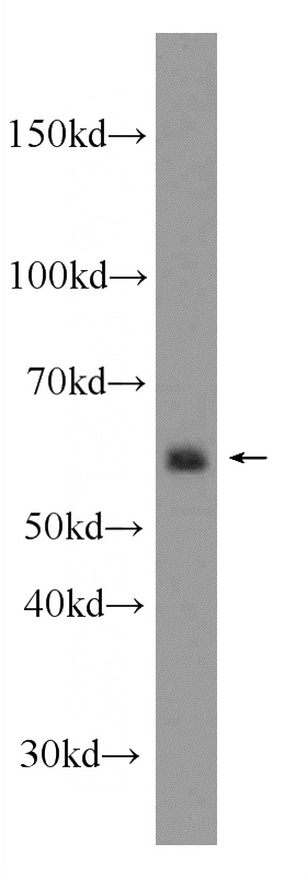 COLO 320 cells were subjected to SDS PAGE followed by western blot with Catalog No:110318(EEPD1 Antibody) at dilution of 1:600