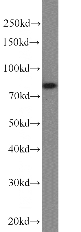 HEK-293 cells were subjected to SDS PAGE followed by western blot with Catalog No:113298(NOL9 antibody) at dilution of 1:1000