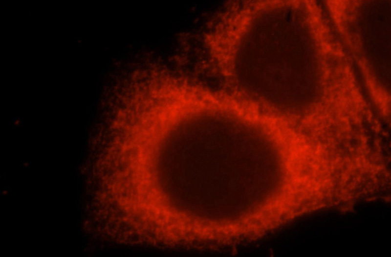 Immunofluorescent analysis of HepG2 cells, using EVI2A antibody Catalog No:110492 at 1:25 dilution and Rhodamine-labeled goat anti-rabbit IgG (red).